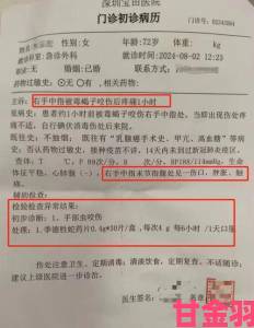 晚报|实名揭露针受虐狂极端奴役折磨产业链受害者血泪控诉书