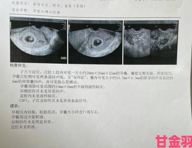 传闻|最新科研成果披露ALPHA孕囊顶开对分娩影响深远