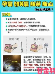 最新科研成果披露ALPHA孕囊顶开对分娩影响深远