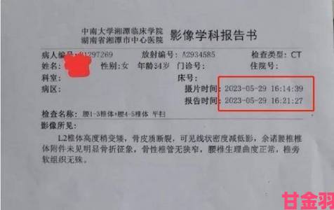 独家|双产骨科年上患者接受双向治疗前必须弄清哪些真相