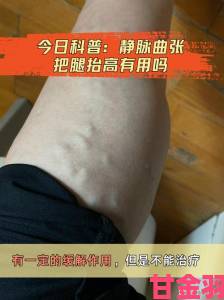 把腿抬高放墙上腿很麻怎么回事科学解释与日常锻炼技巧指南