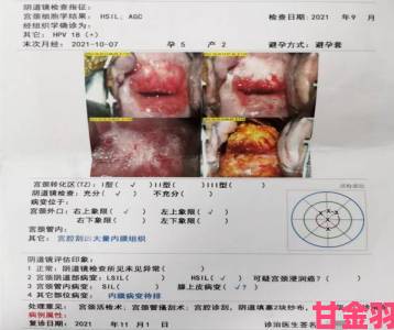 被同桌没戴套干了春雨医生当事人曝露就医记录引医疗伦理大讨论